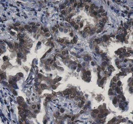 Immunohistochemistry (Formalin/PFA-fixed paraffin-embedded sections) - Anti-APPL antibody [SR3775] (AB326696)