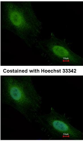 Immunocytochemistry/ Immunofluorescence - Anti-Aprataxin antibody (AB154413)