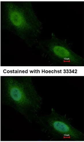 Immunocytochemistry/ Immunofluorescence - Anti-Aprataxin antibody (AB154413)