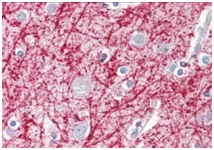 Immunohistochemistry (Formalin/PFA-fixed paraffin-embedded sections) - Anti-APRIL/TNFSF13 antibody (AB189263)