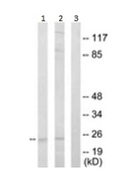 Western blot - Anti-APRIL/TNFSF13 antibody (AB189263)