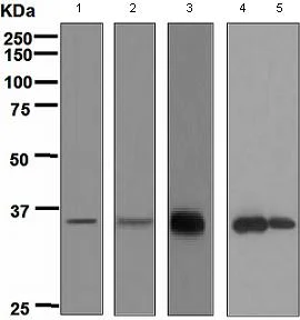 Western blot - Anti-APRIL/TNFSF13 antibody [EPR4286] (AB108206)