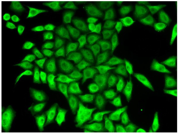 Immunocytochemistry/ Immunofluorescence - Anti-APRT antibody (AB196558)