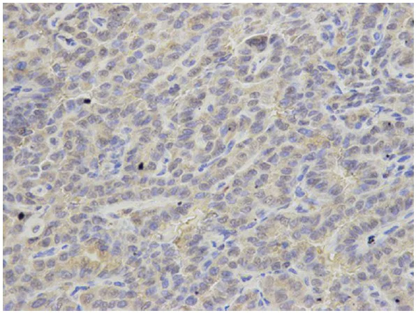 Immunohistochemistry (Formalin/PFA-fixed paraffin-embedded sections) - Anti-APRT antibody (AB196558)