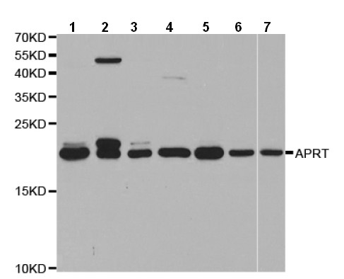 Western blot - Anti-APRT antibody (AB196558)