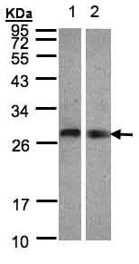 Western blot - Anti-APT-2 antibody (AB151578)