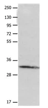 Western blot - Anti-AQP-10 antibody - C-terminal (AB182794)