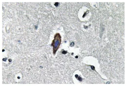 Immunohistochemistry (Formalin/PFA-fixed paraffin-embedded sections) - Anti-AQP0 antibody (AB134695)