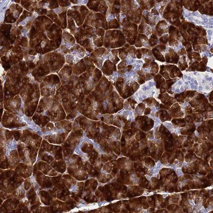 Immunohistochemistry (Formalin/PFA-fixed paraffin-embedded sections) - Anti-AQP12 antibody (AB243487)