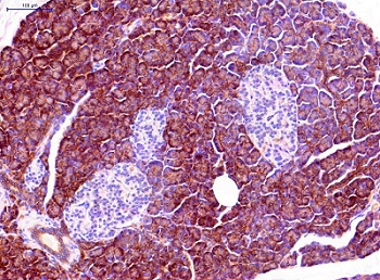 Immunohistochemistry (Formalin/PFA-fixed paraffin-embedded sections) - Anti-Aquaporin 1 antibody [1/22] (AB9566)