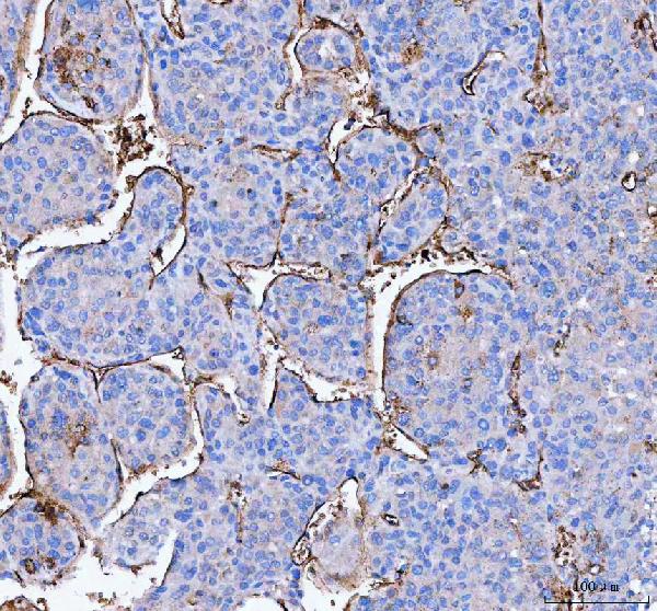 Immunohistochemistry (Formalin/PFA-fixed paraffin-embedded sections) - Anti-Aquaporin 1 antibody (AB65837), expandable thumbnail
