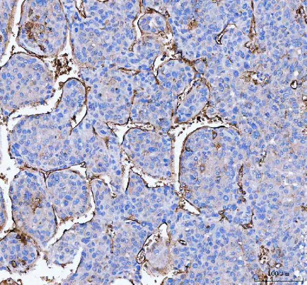 Immunohistochemistry (Formalin/PFA-fixed paraffin-embedded sections) - Anti-Aquaporin 1 antibody (AB65837)