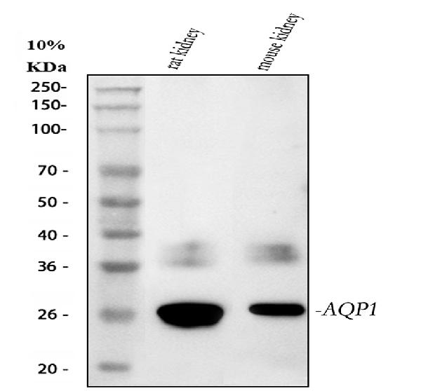 Western blot - Anti-Aquaporin 1 antibody (AB65837), expandable thumbnail