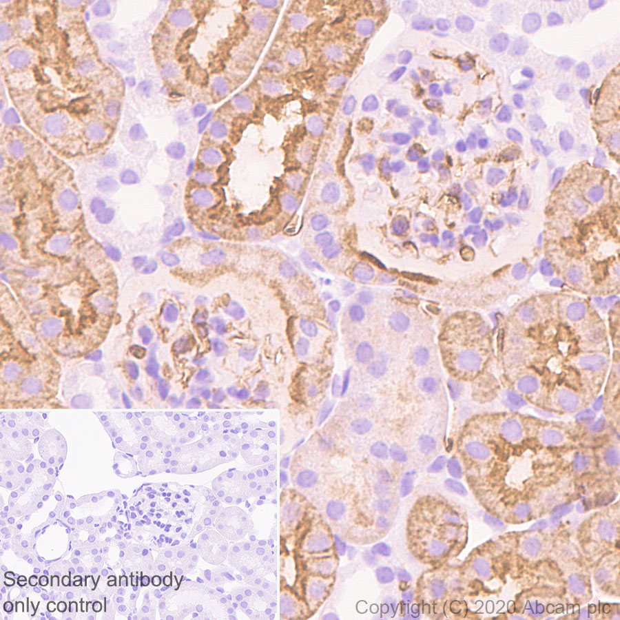 Immunohistochemistry (Formalin/PFA-fixed paraffin-embedded sections) - Anti-Aquaporin 1 antibody [EPR11588(B)] (ab168387), expandable thumbnail