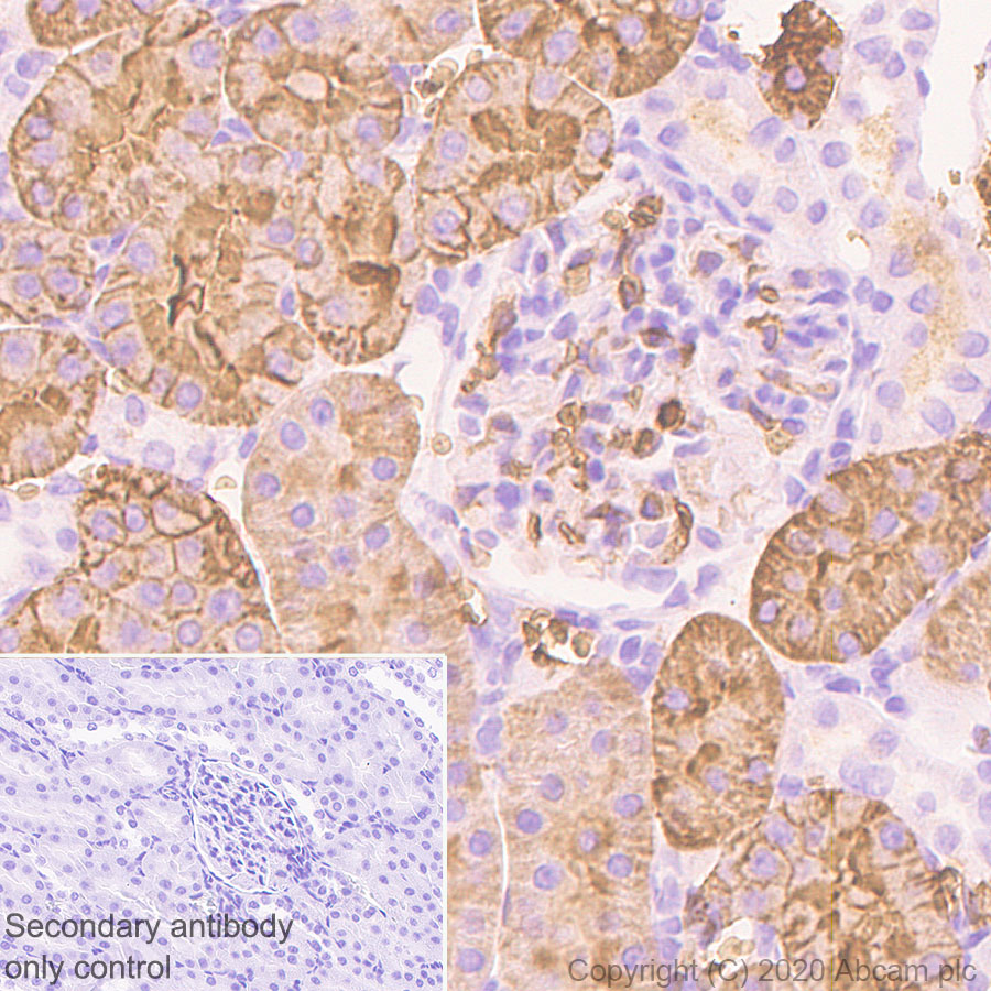 Immunohistochemistry (Formalin/PFA-fixed paraffin-embedded sections) - Anti-Aquaporin 1 antibody [EPR11588(B)] (ab168387), expandable thumbnail