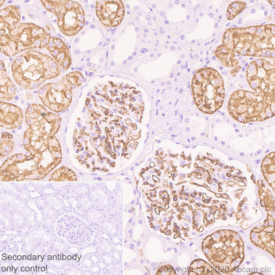Immunohistochemistry (Formalin/PFA-fixed paraffin-embedded sections) - Anti-Aquaporin 1 antibody [EPR11588(B)] (AB168387), expandable thumbnail