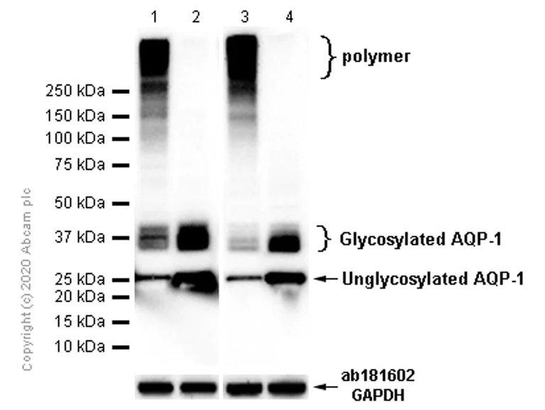 Western blot - Anti-Aquaporin 1 antibody [EPR11588(B)] (AB168387)