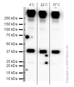 Western blot - Anti-Aquaporin 1 antibody [EPR11588(B)] (AB168387)
