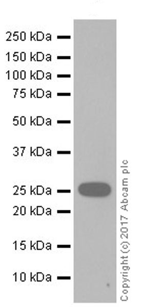 Western blot - Anti-Aquaporin 1 antibody [EPR20325] (AB219055), expandable thumbnail