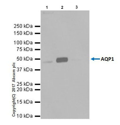 Immunoprecipitation - Anti-Aquaporin 1 antibody [EPR20325] - BSA and Azide free (AB232399), expandable thumbnail