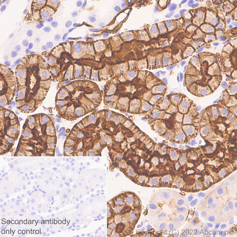 Immunohistochemistry (Formalin/PFA-fixed paraffin-embedded sections) - Anti-Aquaporin 1 antibody [EPR26554-46] (AB300463)