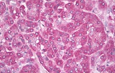 Immunohistochemistry (Formalin/PFA-fixed paraffin-embedded sections) - Anti-Aquaporin 1 antibody - N-terminal (AB189291), expandable thumbnail
