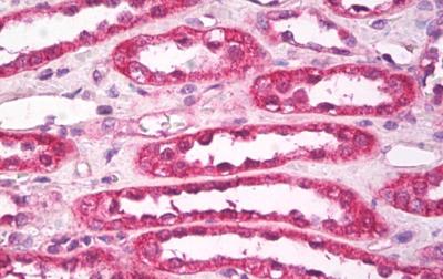 Immunohistochemistry (Formalin/PFA-fixed paraffin-embedded sections) - Anti-Aquaporin 1 antibody - N-terminal (AB189291), expandable thumbnail