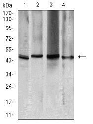 Western blot - Anti-Aquaporin 2 antibody [7H8B5] (AB233742)