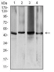 Western blot - Anti-Aquaporin 2 antibody [7H8B5] (AB233742)