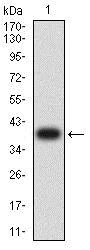 Western blot - Anti-Aquaporin 2 antibody [7H8B5] (AB233742)