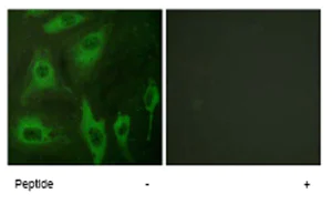 Immunocytochemistry/ Immunofluorescence - Anti-Aquaporin 2 antibody (AB62628)