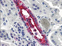 Immunohistochemistry (Formalin/PFA-fixed paraffin-embedded sections) - Anti-Aquaporin 2 antibody (AB78230)