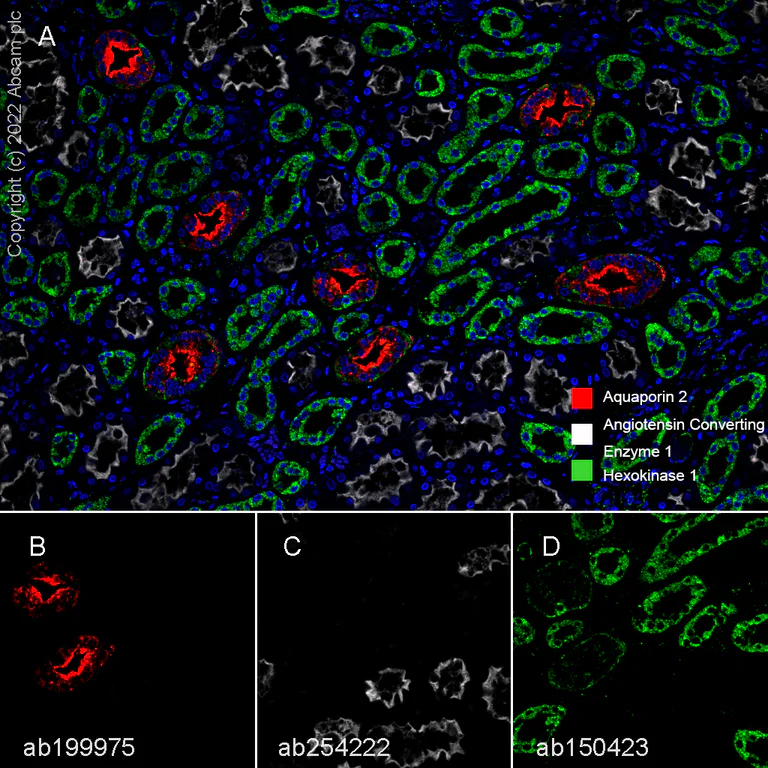 Multiplex immunohistochemistry - Anti-Aquaporin 2 antibody [EPR21080] (AB199975)