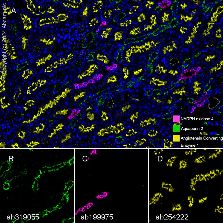 Multiplex immunohistochemistry - Anti-Aquaporin 2 antibody [EPR21080] (AB199975)