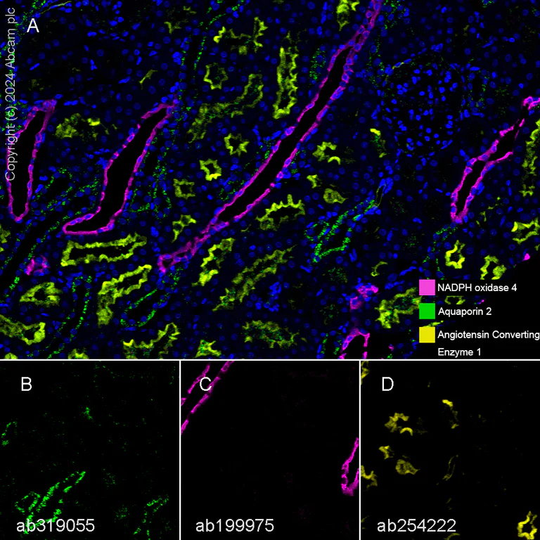 Multiplex immunohistochemistry - Anti-Aquaporin 2 antibody [EPR21080] (AB199975)
