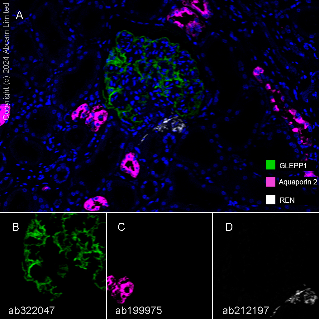Multiplex immunohistochemistry - Anti-Aquaporin 2 antibody [EPR21080] (AB199975)