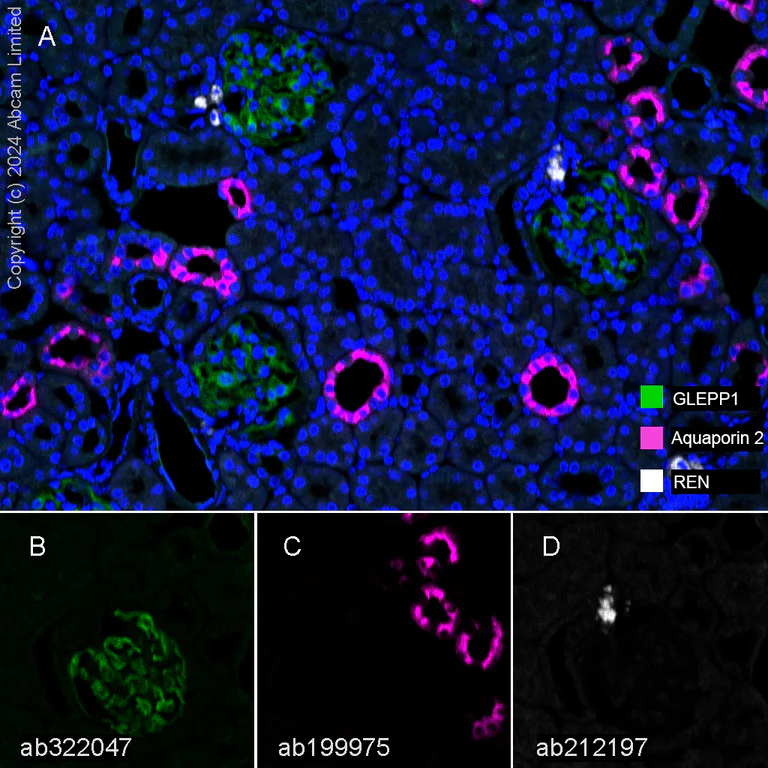 Multiplex immunohistochemistry - Anti-Aquaporin 2 antibody [EPR21080] (AB199975)