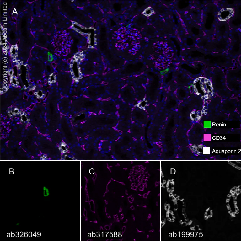 Multiplex immunohistochemistry - Anti-Aquaporin 2 antibody [EPR21080] (AB199975)