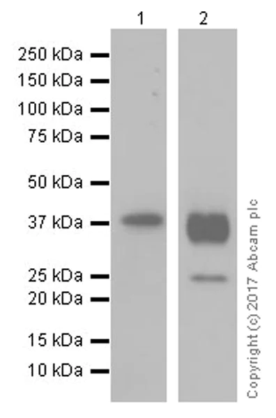 Western blot - Anti-Aquaporin 2 antibody [EPR21080] (AB199975)