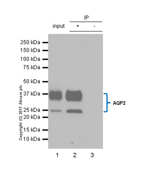 Immunoprecipitation - Anti-Aquaporin 2 antibody [EPR21080] - BSA and Azide free (AB230170)