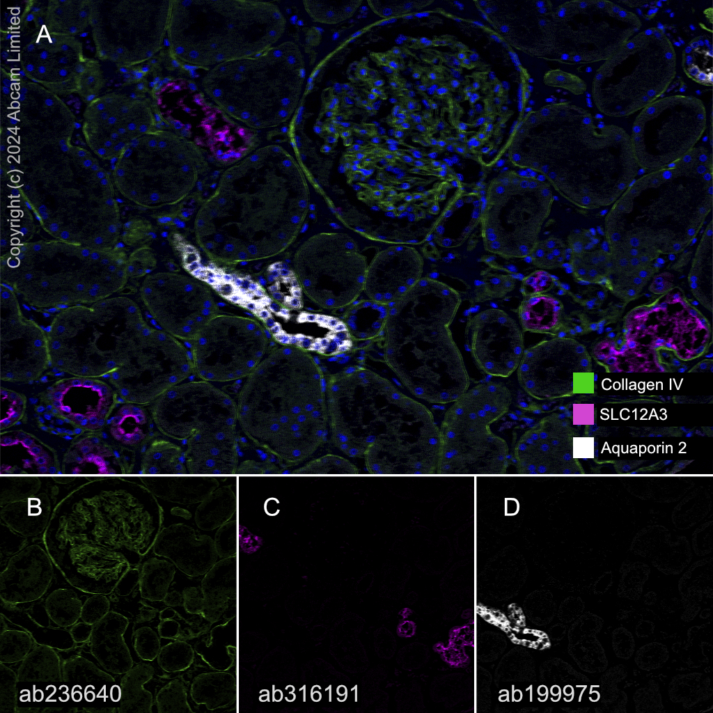 Multiplex immunohistochemistry - Anti-Aquaporin 2 antibody [EPR21080] - BSA and Azide free (AB230170)