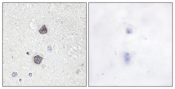 Immunohistochemistry (Formalin/PFA-fixed paraffin-embedded sections) - Anti-Aquaporin 2 (phospho S256) antibody (AB111346)