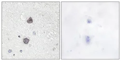 Immunohistochemistry (Formalin/PFA-fixed paraffin-embedded sections) - Anti-Aquaporin 2 (phospho S256) antibody (AB111346)