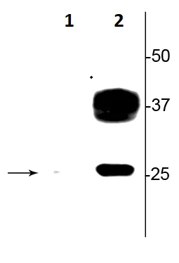 Western blot - Anti-Aquaporin 2 (phospho S269) antibody (AB254072)