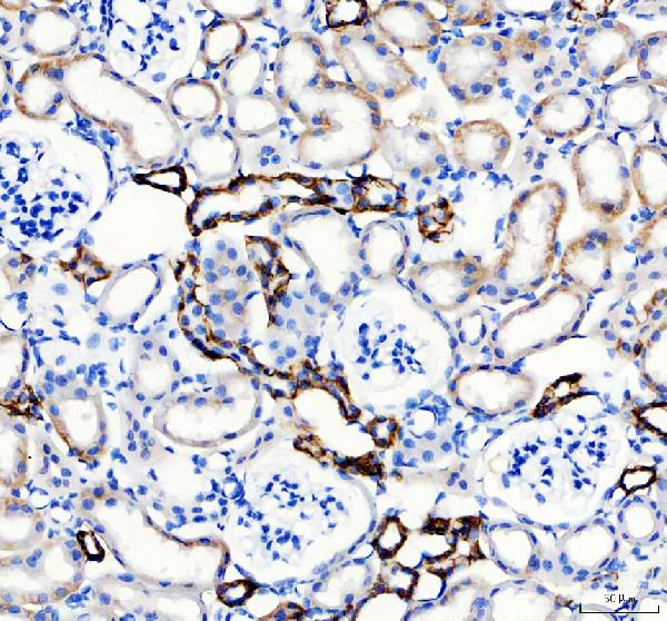 Immunohistochemistry (Formalin/PFA-fixed paraffin-embedded sections) - Anti-Aquaporin 3 antibody (ab125219), expandable thumbnail