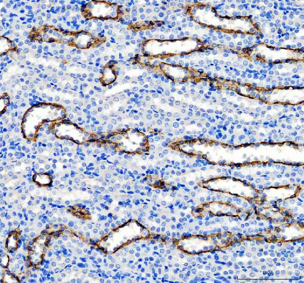 Immunohistochemistry (Formalin/PFA-fixed paraffin-embedded sections) - Anti-Aquaporin 3 antibody (ab125219), expandable thumbnail