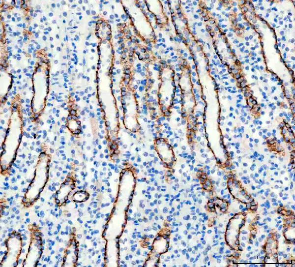 Immunohistochemistry (Formalin/PFA-fixed paraffin-embedded sections) - Anti-Aquaporin 3 antibody (AB125219)