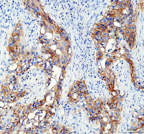Immunohistochemistry (Formalin/PFA-fixed paraffin-embedded sections) - Anti-Aquaporin 3 antibody (ab125219), expandable thumbnail