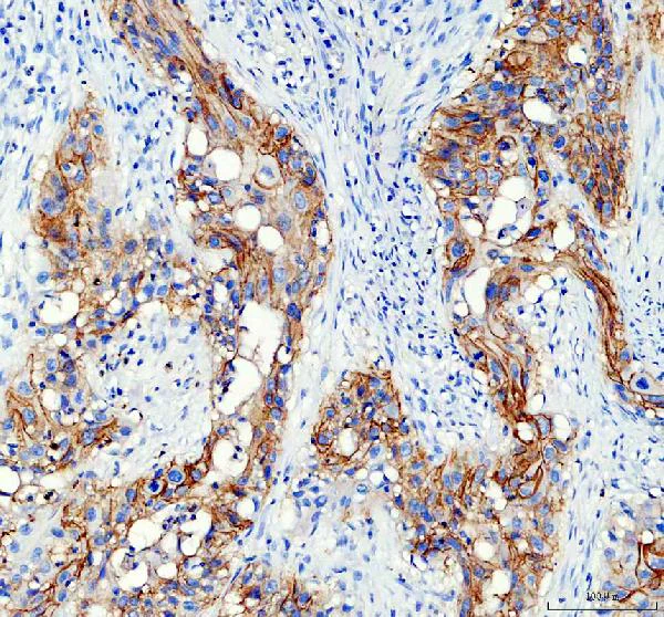 Immunohistochemistry (Formalin/PFA-fixed paraffin-embedded sections) - Anti-Aquaporin 3 antibody (AB125219)