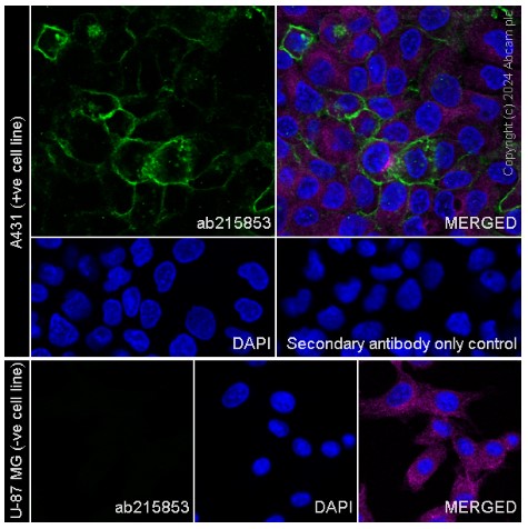 Immunocytochemistry/ Immunofluorescence - Anti-Aquaporin 3 antibody [EPR19932] (ab215853), expandable thumbnail